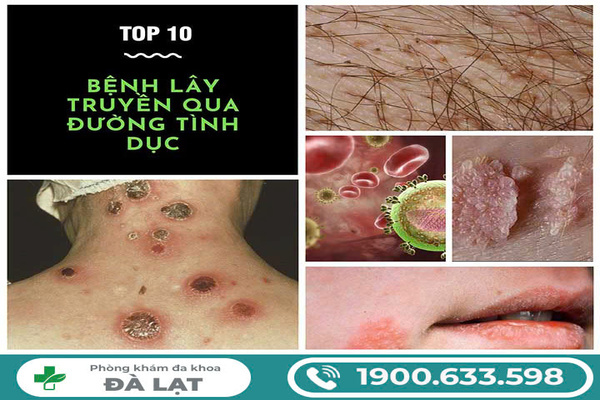 Hình ảnh minh họa